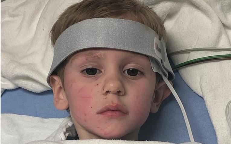 El niño durante su recuperación en el hospital.