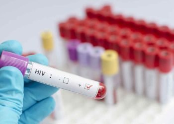 Blood test to identify HIV. Photo: telemundo.com / Archive.