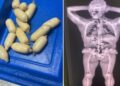 Cocaine capsules detected by Cuban Customs as they attempted to smuggle them into Havana airport. Photo: Taken from the X profile of Wiliam Pérez González, First Deputy Chief of the General Customs Office of the Republic of Cuba.