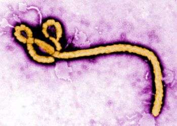 El virus del ébola visto en una imagen micrográfica electrónica coloreada, sin fecha, provista por los Centros de Control de Enfermedades de EEUU. Foto: Frederick Murphy / CDC vía AP / Archivo.