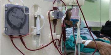 Los casos de Enfermedad Renal Crónica se han incrementado en Cuba en los últimos años. Foto: Yaimí Ravelo / Granma.