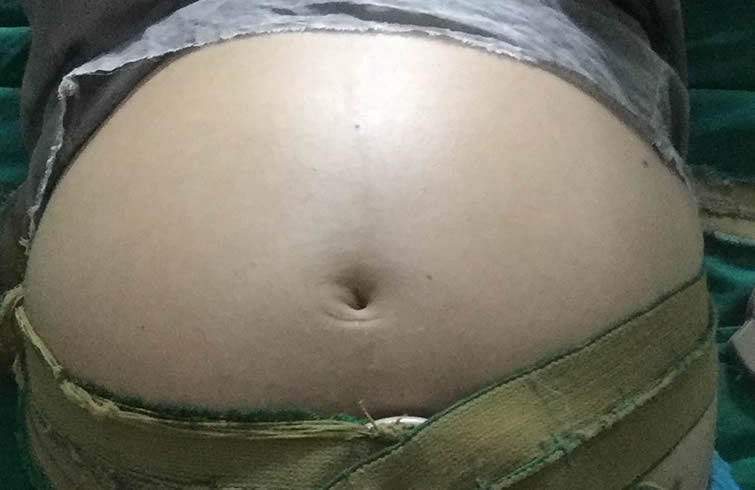 Embarazo de Marta María Ramírez. Siete meses.