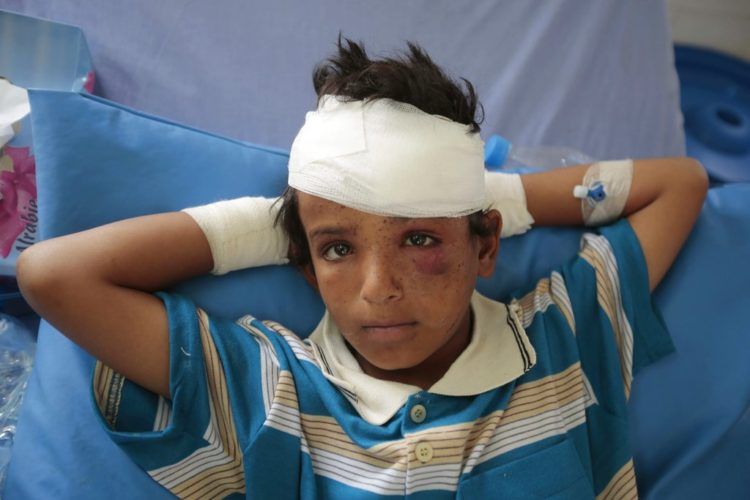 Fotografía de archivo del 12 de agosto de 2018 de un niño lesionado en un ataque aéreo de la coalición liderada por Arabia Saudí en un hospital en Sadá, Yemen. (AP Foto/Hani Mohammed, archivo)