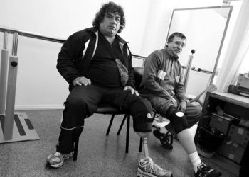 Pacientes uruguayos con prótesis colocadas por el convenio entre Uruguay y Cuba. Foto: ladiaria.com.uy
