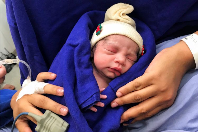 Esta fotografía del 15 de diciembre de 2017 proporcionada por el médico Wellington Andraus muestra a la bebé que nació de una mujer que recibió un trasplante de útero de una donante fallecida en Sao Paulo, Brasil. (Cortesía del doctor Wellington Andraus vía AP)