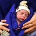 Esta fotografía del 15 de diciembre de 2017 proporcionada por el médico Wellington Andraus muestra a la bebé que nació de una mujer que recibió un trasplante de útero de una donante fallecida en Sao Paulo, Brasil. (Cortesía del doctor Wellington Andraus vía AP)