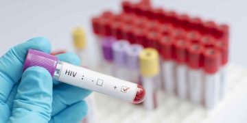 Test de sangre para identificar el VIH. Foto: telemundo.com / Archivo.