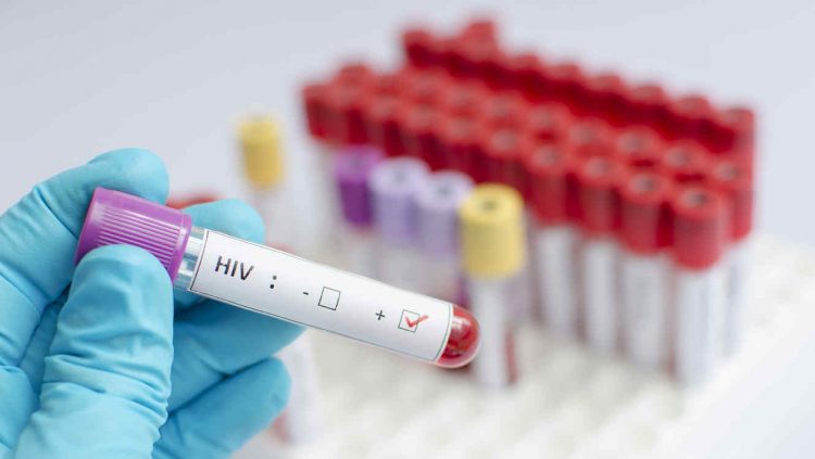 Test de sangre para identificar el VIH. Foto: telemundo.com / Archivo.