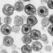 Esta imagen tomada con un microscopio electrónico y difundida por los Centros para el Control y la Prevención de Enfermedades de Estados Unidos (CDC, por sus siglas en inglés) muestra viriones del VIH. Foto: Maureen Metcalfe, Tom Hodge/CDC vía AP.