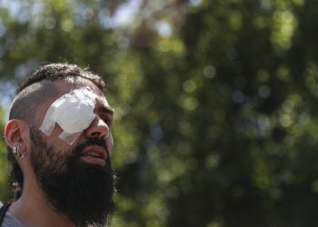 Marcelo Herrera, con los ojos vendados por una lesión que sufrió durante una protesta reciente, participa en una manifestación en Santiago, Chile, el jueves 28 de noviembre de 2019. Foto: Esteban Felix / AP.