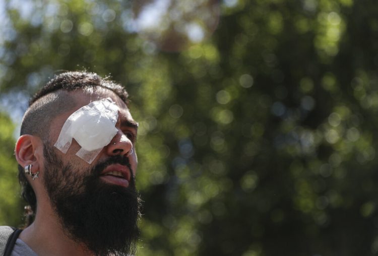 Marcelo Herrera, con los ojos vendados por una lesión que sufrió durante una protesta reciente, participa en una manifestación en Santiago, Chile, el jueves 28 de noviembre de 2019. Foto: Esteban Felix / AP.
