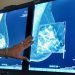 Imagen de archivo que muestra una prueba de detección de cáncer de mama. Foto: Torin Halsey/Times Record News vía AP/Archivo.