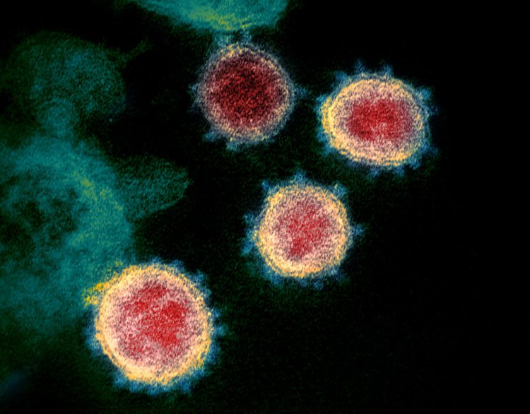 Foto tomada a través de microscopio del coronavirus que causa el COVID-19.