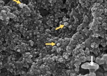 Una de las microfotografías de la muestra tomada a un paciente con coronavirus en Cuba. Foto: @cuba_cea/Twitter.