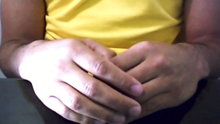 Esta imagen tomada de un video muestra las manos de un brasileño que estaba infectado con el virus del SIDA y no ha mostrado ningún indicio del mismo por más de un año después de haber dejado de tomar medicamentos para el VIH. Foto: Federica Narancio/Zoom vía AP.