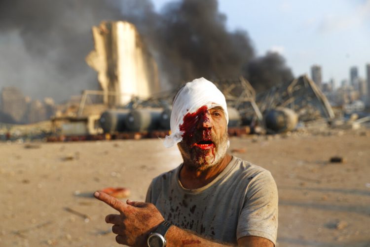 Un hombre herido se aleja del lugar de una explosión en Beirut, Líbano, el martes 4 de agosto de 2020. Foto: Hussein Malla/AP.