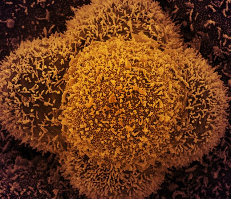 Células CCL-81 (células Vero utilizadas en investigación) fuertemente infectadas con partículas del virus SARS-CoV-2. NIAID / Flickr, CC BY-SA