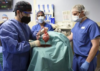 Cirujanos de la Universidad de Maryland muestran el corazón de cerdo que se va a trasplantar a David Bennett. Hoy lunes el hospital dijo que el paciente está bien después de esta cirugía altamente experimental. Foto: AP.