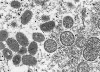 Vista microscópica de viriones maduros de Viruela del Mono. Foto: Cynthia S. Goldsmith, Russell Regner/CDC, vía AP, Archivo.