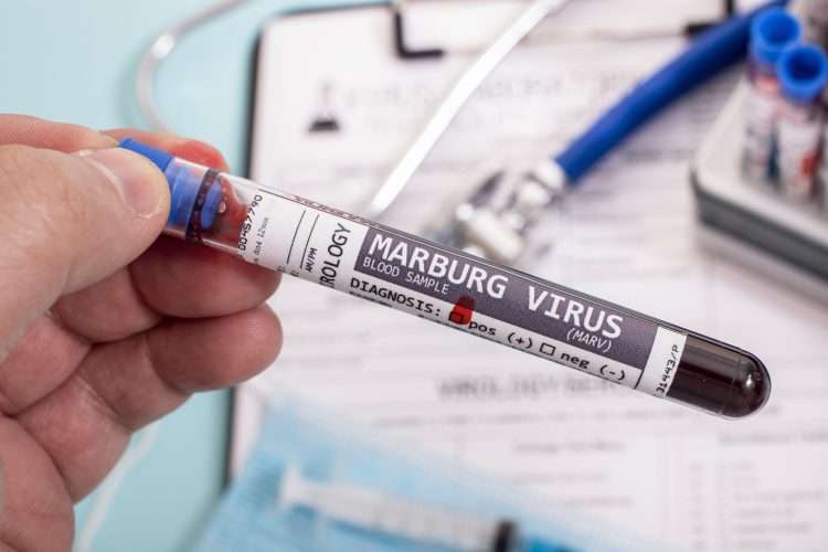 Virus de Marburgo. Foto: tomada de Forbes Africa.