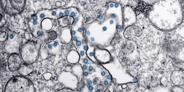 Partículas del virus SARS-CoV-2, coloreadas en azul, en una imagen de microscopio de electrones. Foto: EFE/Imagen cedida por el Consejo Superior de Investigaciones Científicas (CSIC).