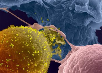 Linfocito infectado por VIH-1 (pseudo-amarillo) en contacto con linfocitos no infectados (azul y rosa). Las partículas virales están en amarillo claro. Foto: Instituto Pasteur