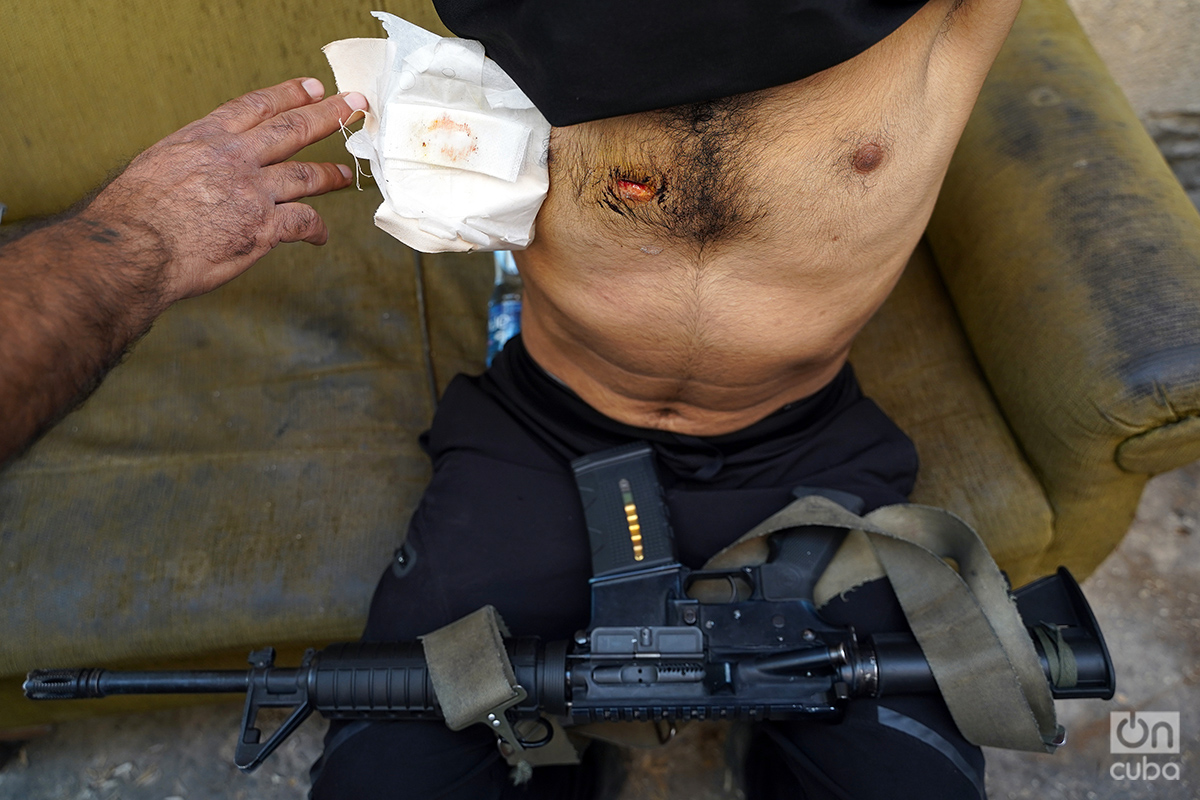 Miliciano de la Brigada Tulkarem muestra la herida recibida durante la última incursión del ejército de Israel en el campo de refugiados palestinos de Nur Shams, hace apenas cinco días. Foto: Alejandro Ernesto.