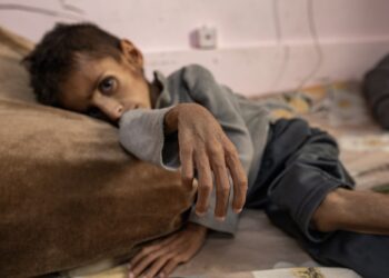 Niño palestino de cinco años, Osama al-Raqab, sufre desnutrición severa, recibe tratamiento en el Hospital Nasser en Khan Yunis, sur de la Franja de Gaza. Foto: HAITHAM IMAD/EFE/EPA