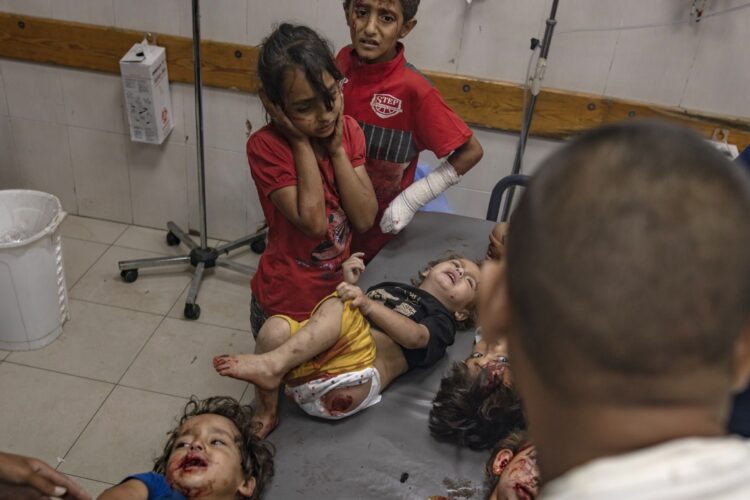 Niños palestinos heridos reciben tratamiento en el Hospital Nasser tras los bombardeos israelíes cerca de las tiendas de campaña de desplazados al oeste de Khan Yunis, al sur de la Franja de Gaza, el 6 de junio de 2025. Foto: EFE/EPA/HAITHAM IMAD