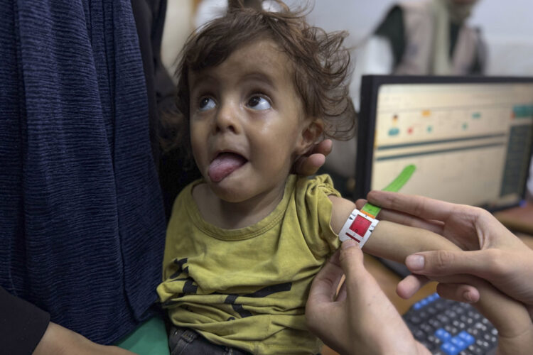 Madres, bebés y médicos hambrientos en el único hospital que trata la desnutrición en Gaza. Foto:  EFE/Ahmad Awad.
