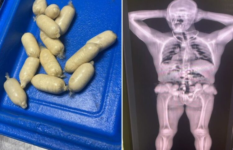 Cápsulas de cocaína detectadas por la Aduana de Cuba cuando intentaban introducirlas en el aeropuerto de La Habana. Foto: Tomada del perfil en X de Wiliam Pérez González, vice jefe primero de la Aduana General de la República de Cuba.