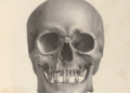 Litografía de un cráneo propiedad de Samuel Morton, publicado en su obra "Crania Americana".